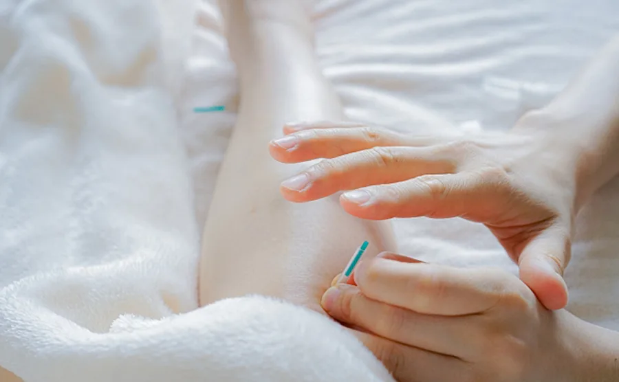 膝の裏に針治療を受けている画像