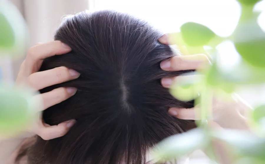 頭をかかえて髪の分け目から頭皮を見せている若い女性の画像
