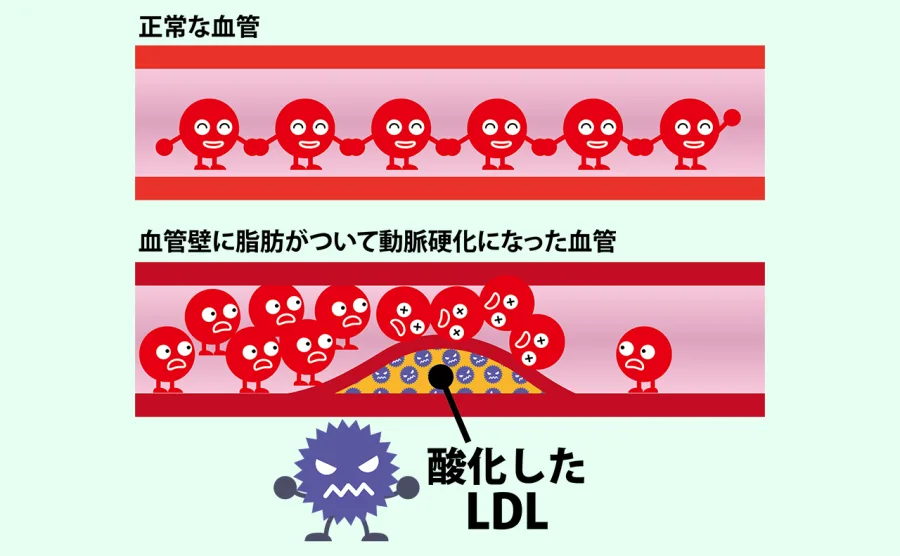 酸化をイメージしたイラスト図