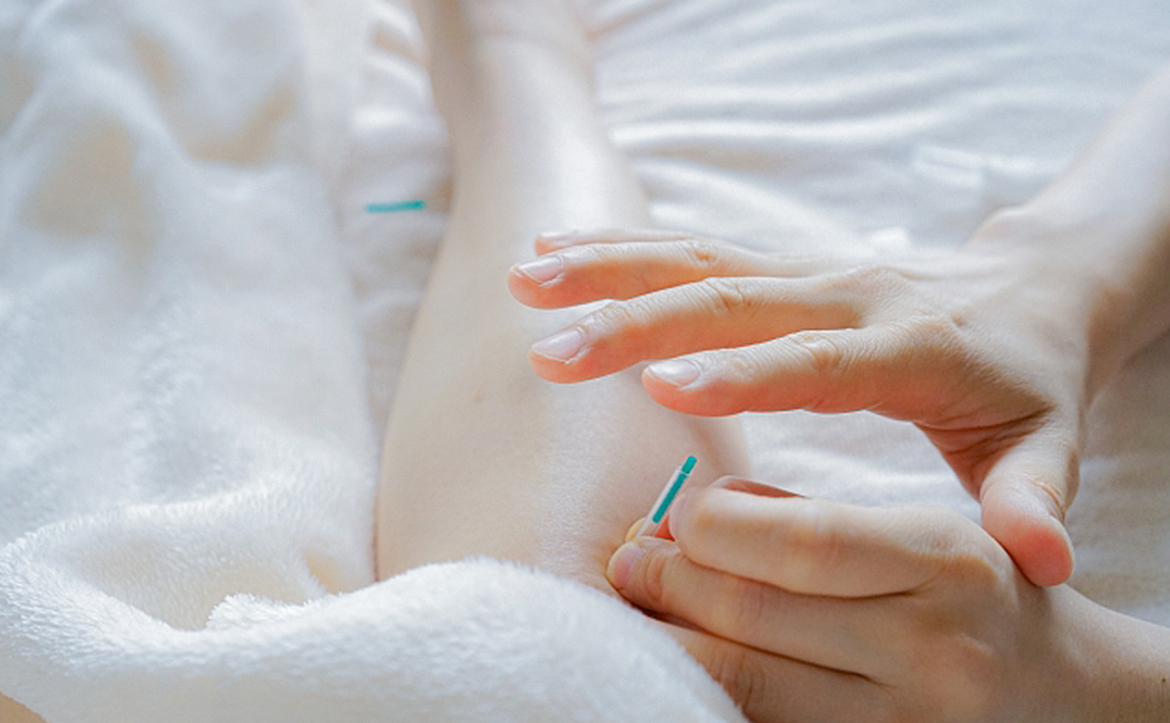 膝の裏に針治療を受けている画像